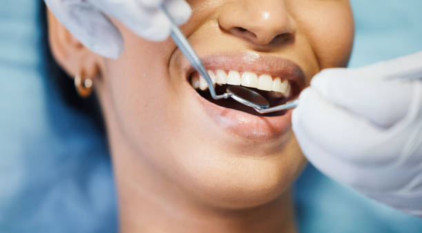 Best Emergency Dentist for Lost Fillings or Crowns in Greenbelt, MD